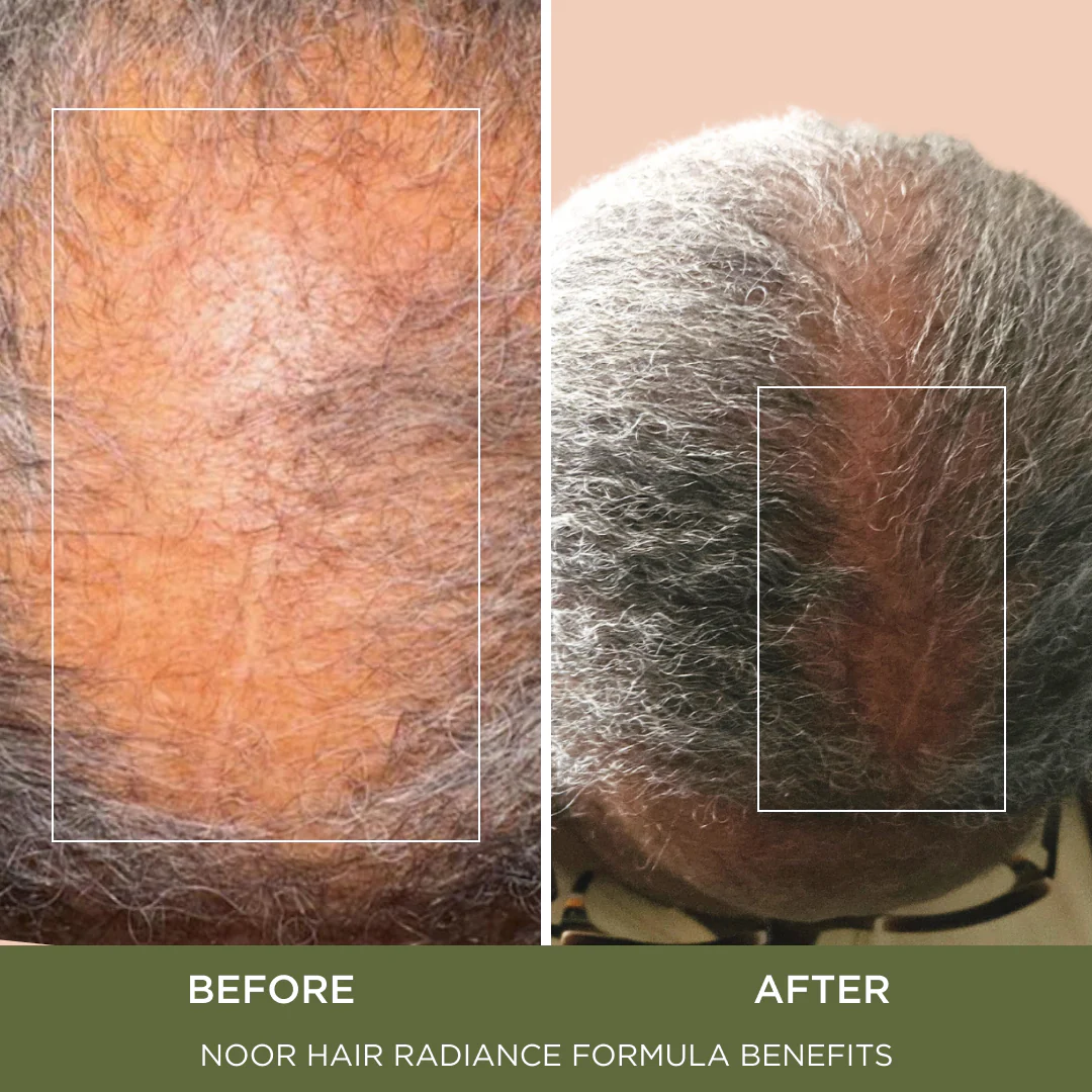 Radiance Formula - Image 5